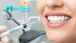 بلیچینگ اولترادنت