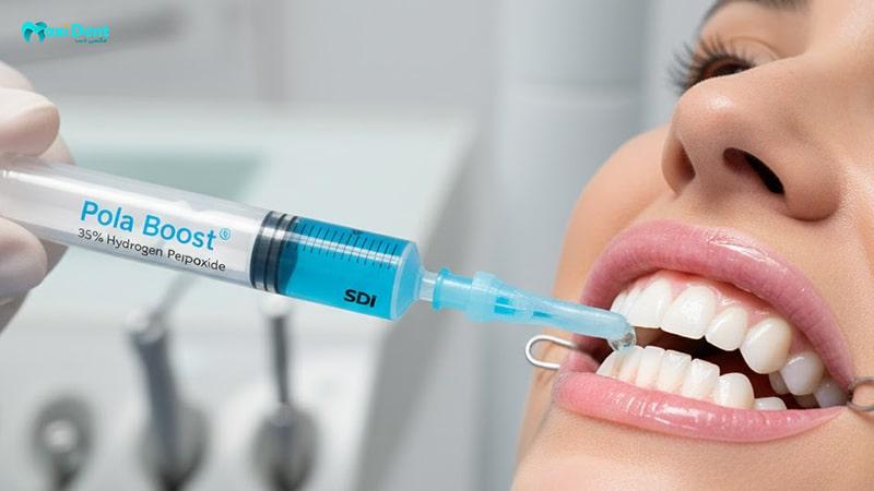 بلیچینگ پولا بوست