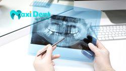 بهترین فیلم های رادیوگرافی