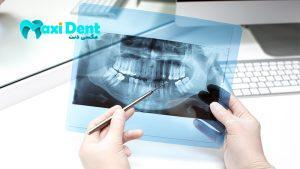 بهترین فیلم های رادیوگرافی