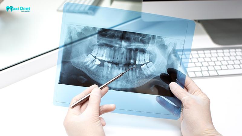 بهترین فیلم های رادیوگرافی