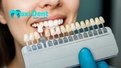 برند کامپوزیت