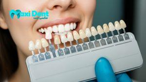 بهترین برندهای کامپوزیت ۲۰۲۵