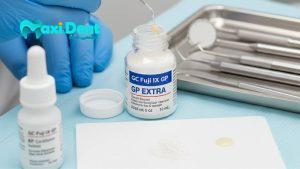 بهترین برندهای گلاس آینومر